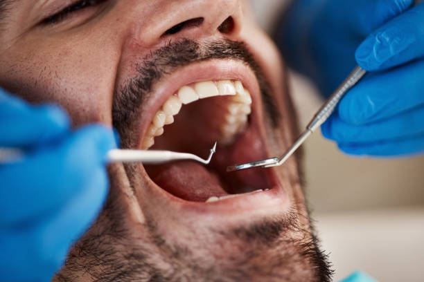 Best Broken or Cracked Tooth Emergency Dentist in White Sulphur Springs, MT